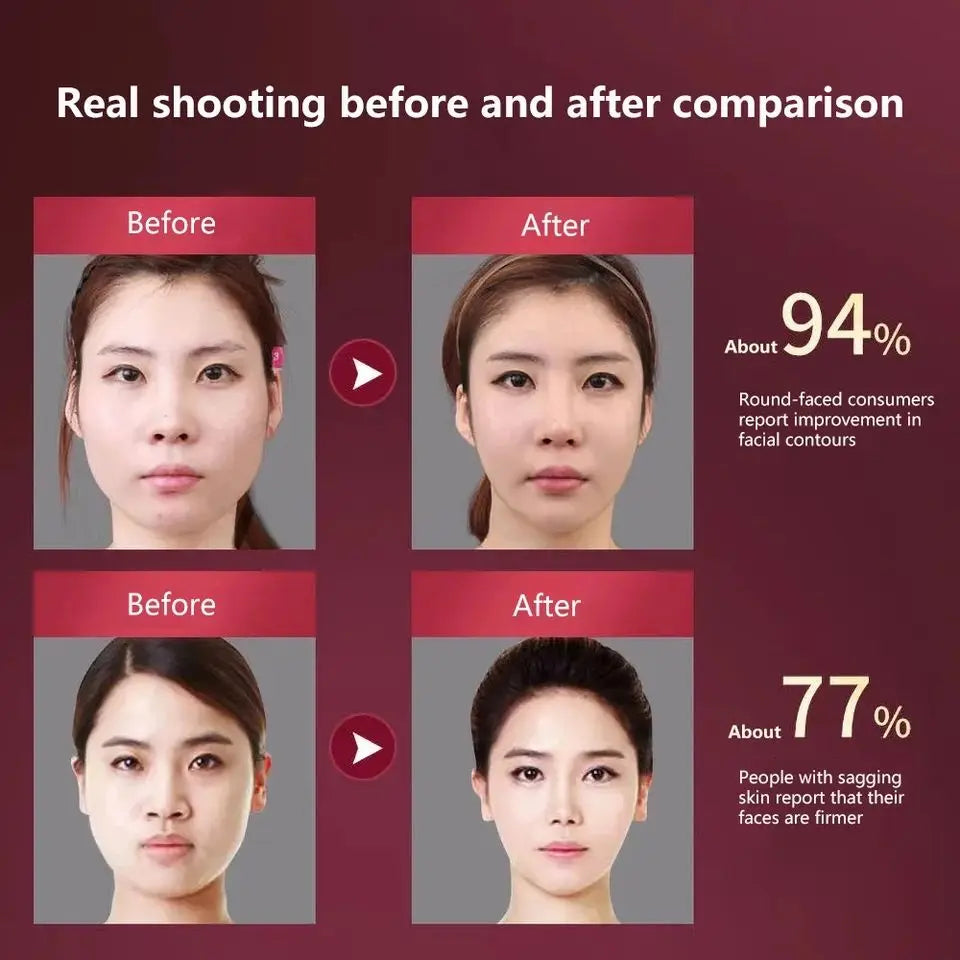 V-Face LED Lifting Device — Anti-Aging Skin Tightening Massager