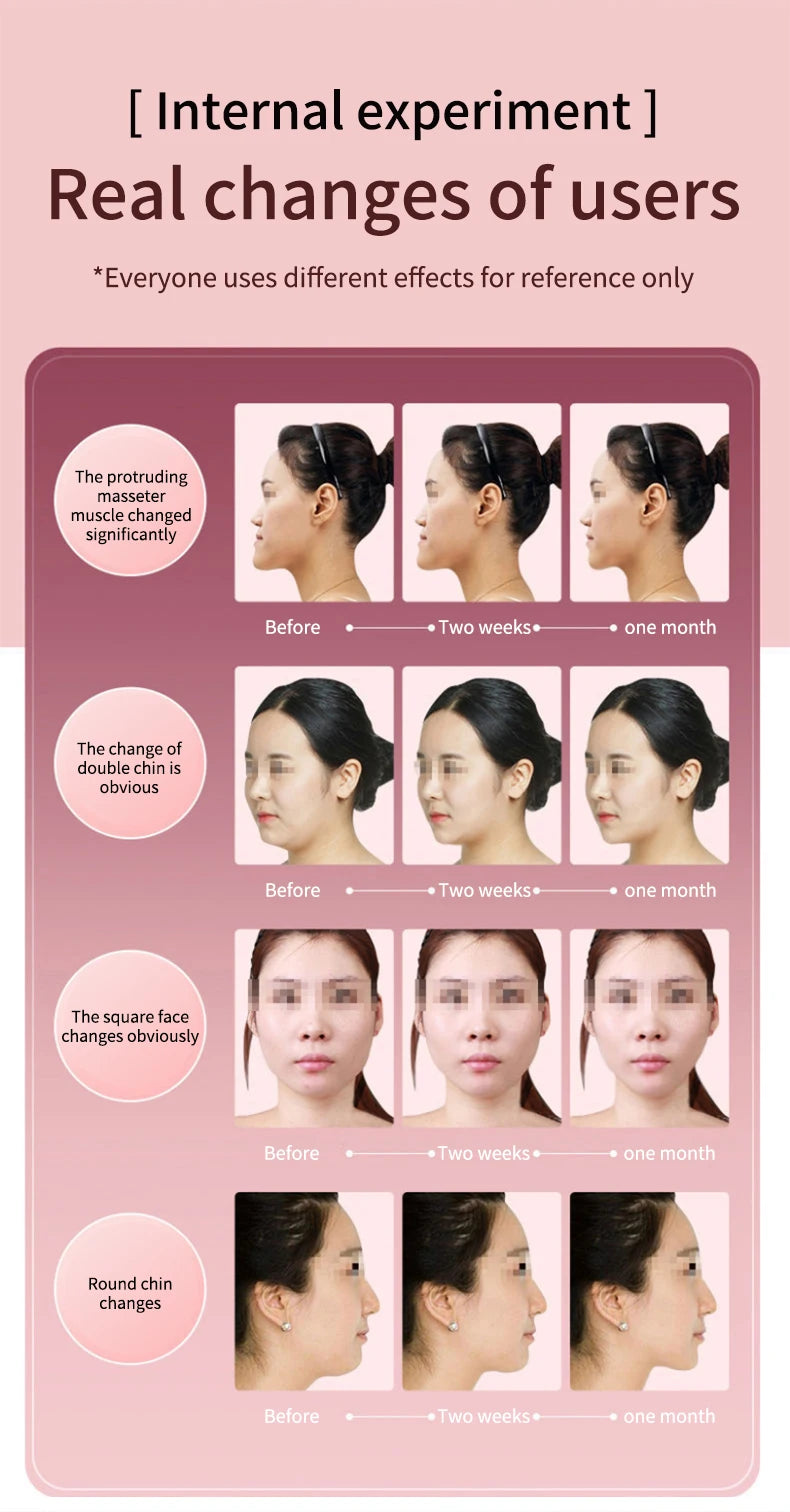 V-Face LED Lifting Device — Anti-Aging Skin Tightening Massager